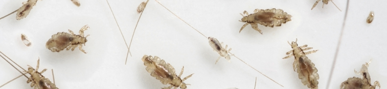 f37fadb1-3354-4b27-a3b1-d049c1734096_Head_lice_-_int_banner.jpg